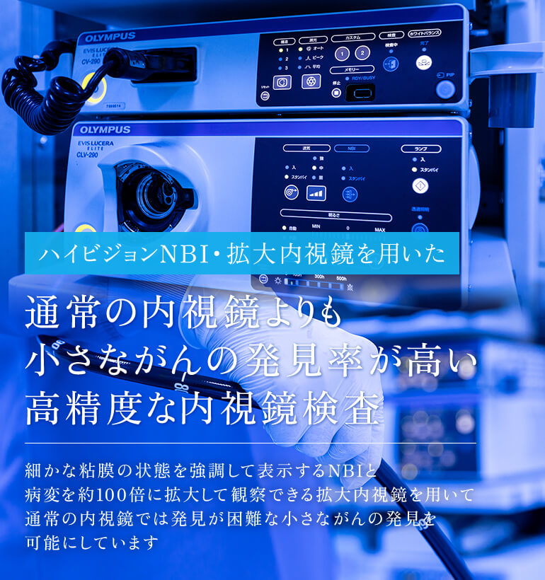 ハイビジョンNBI・拡大内視鏡を用いた 通常の内視鏡よりも小さながんの発見率が高い高精度な内視鏡検査 細かな粘膜の状態を強調して表示するNBIと、病変を約100倍に拡大して観察できる拡大内視鏡を用いて、通常の内視鏡では発見が困難な小さな病変の発見も可能にしています　駐車場完備/大塚池端バス停 徒歩2分